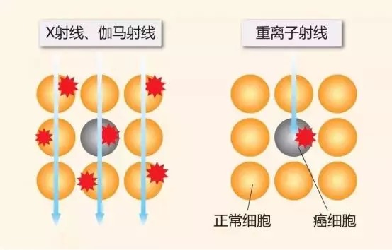 質(zhì)子重離子技術(shù)醫(yī)療險(xiǎn)可以報(bào)銷嗎？